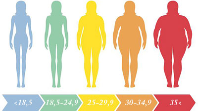 Per didelis kūno masės indeksas gali turėti įtakos sąnarių sveikatai.